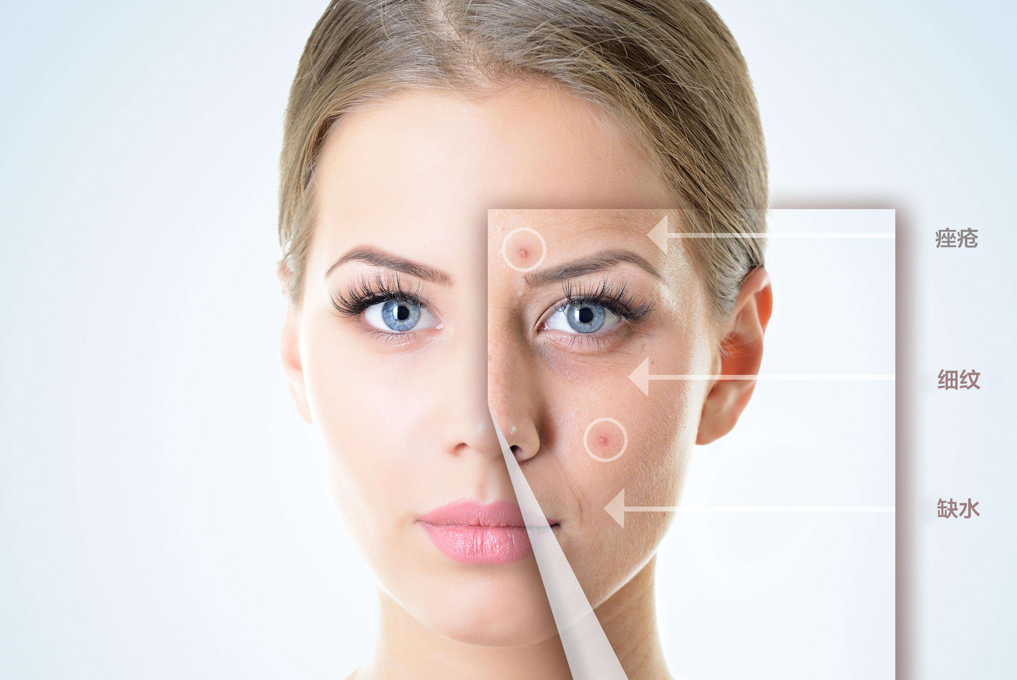 皮膚管理中心,水光注射